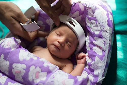 Photo of infant wearing medical device